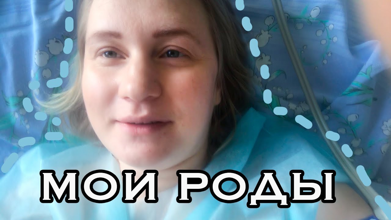 Мои роды | Кесарево сечение в сознании
