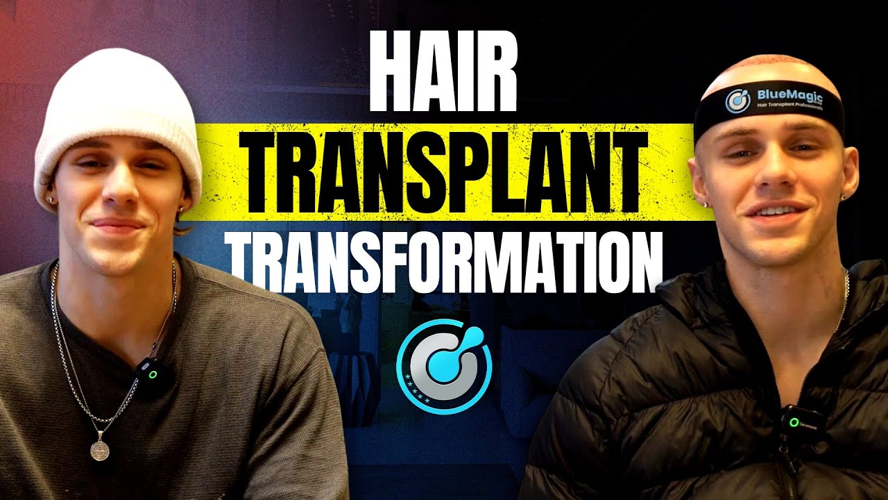 REAL Before And Afters:Hair Transplant Result, Turkish Clinic for EU and US People | BlueMagic Group