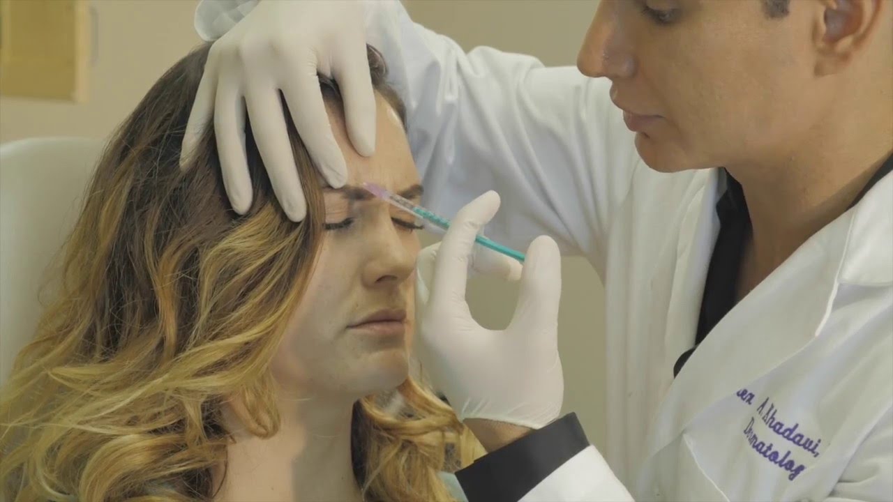 How Botox is injected in the forehead to reduce forehead wrinkles