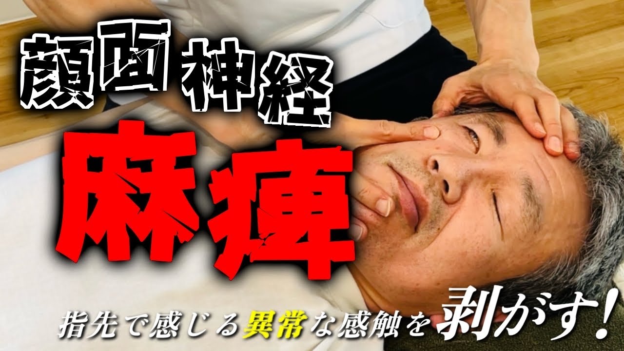 【顔面神経麻痺】困っている人は見て！痺れ・滑舌ぜ〜んぶ劇的に変わります！