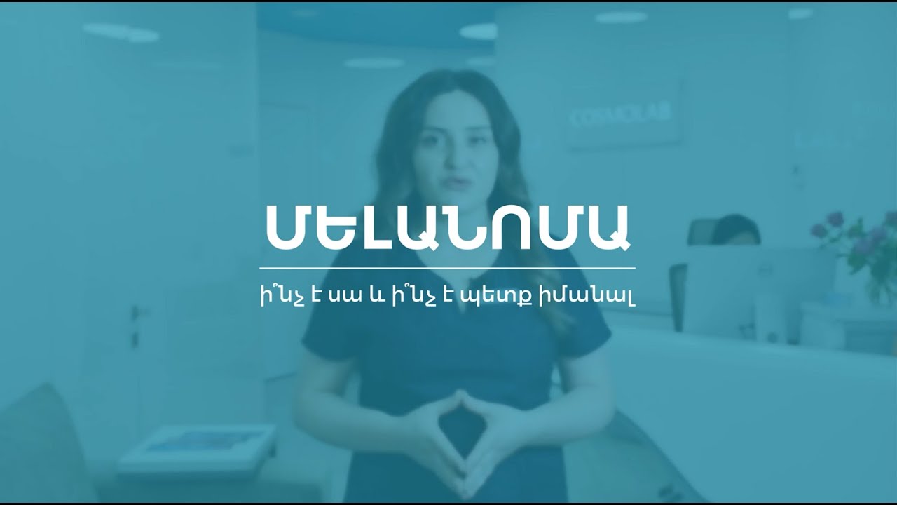 Մելանոմա | Մաշկի ամենաչարորակ քաղցկեղ