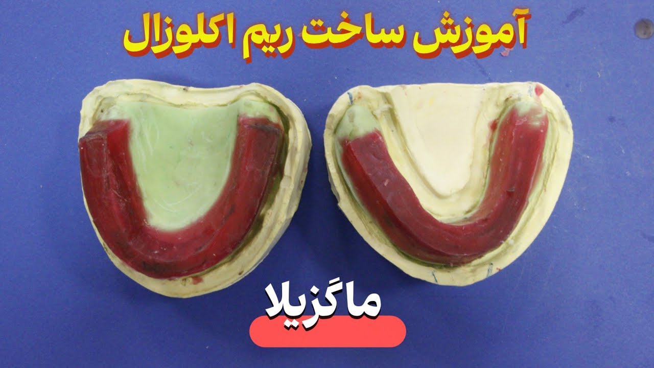 پروتز کامل - ساخت ریم اکلوزال (بخش دوم) | ریم ماگزیلا