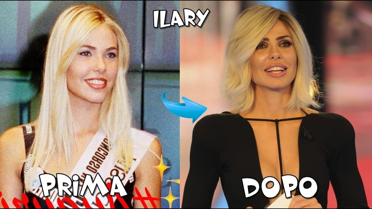 GRANDE FRATELLO VIP & PRIMA E DOPO 2018