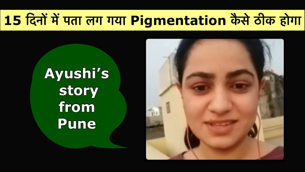 Ayushi’s story from Pune, “15 दिनों में पता लग गया Pigmentation कैसे ठीक होगा”