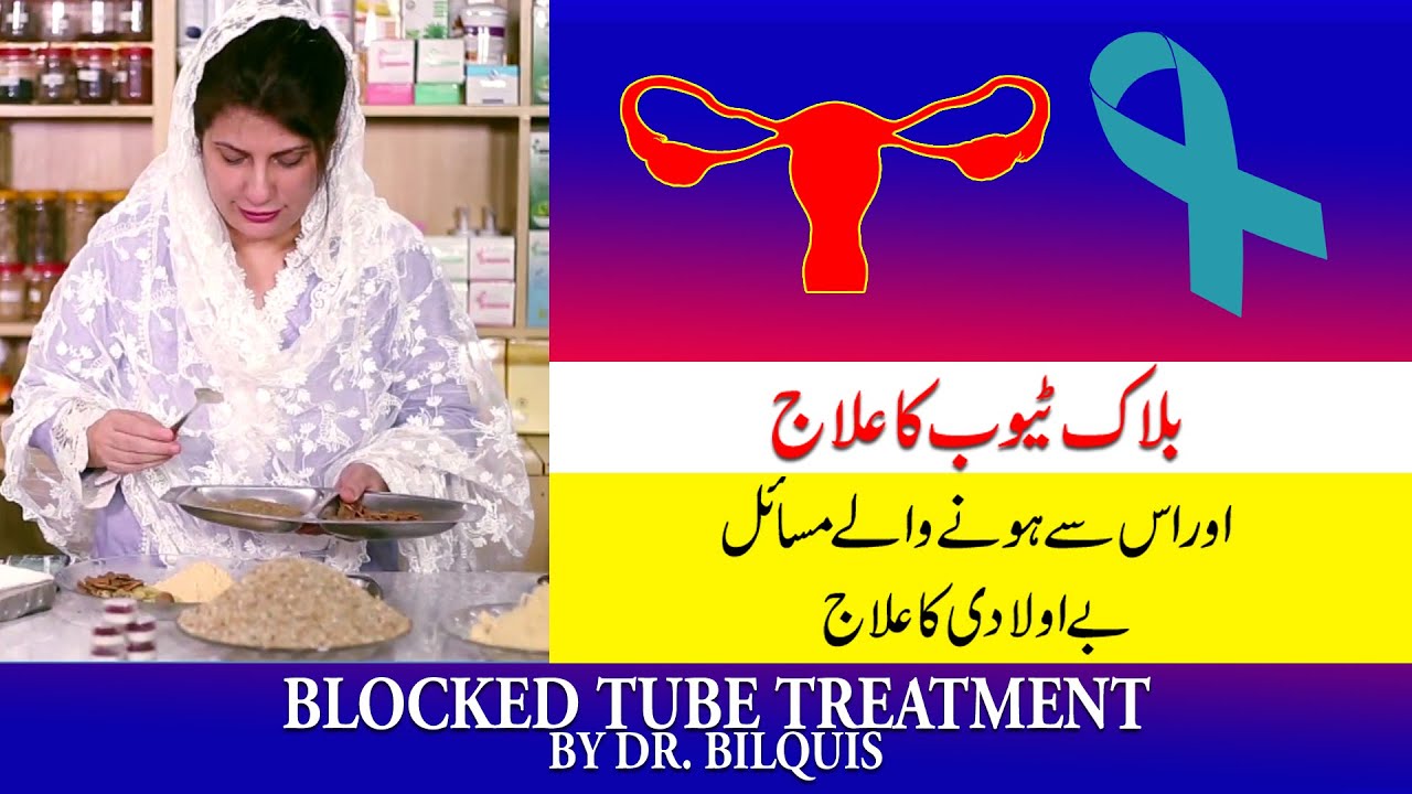 Blocked Tubes Treatment by Dr. Bilquis Shaikh || Female Infertility ||  || Be Auladi ka I