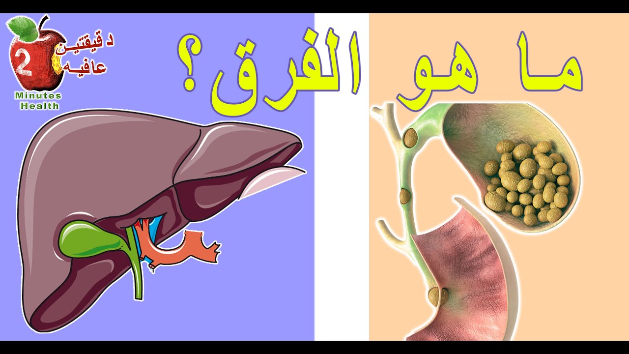 ألم  البطن | علامات الفرق بين الم المرارة و الم الكبد