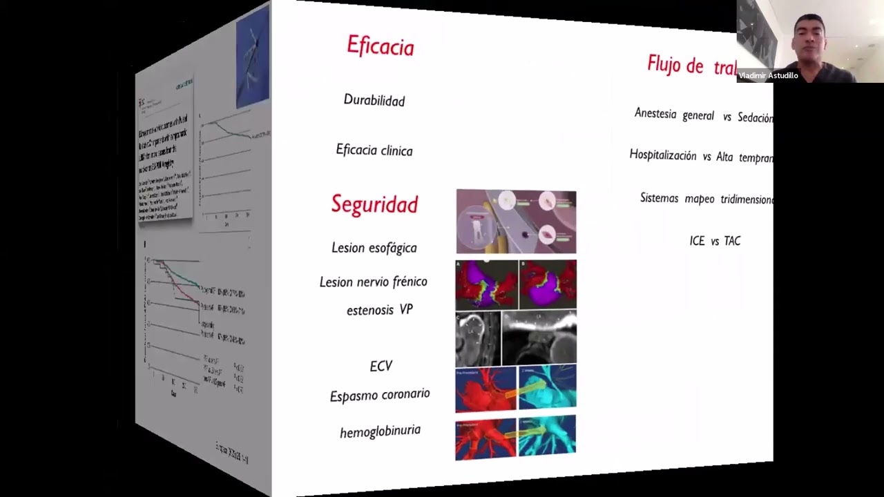 PFA, radiofrecuencia y crioablación: diferencias, pros y contras - Dr. Vladimir Astudillo