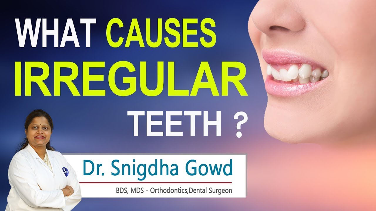 Hi9 | What Causes Irregular Teeth? | Dr.Snigdha Gowd | Orthodontics & Dentofacial Orthodontics