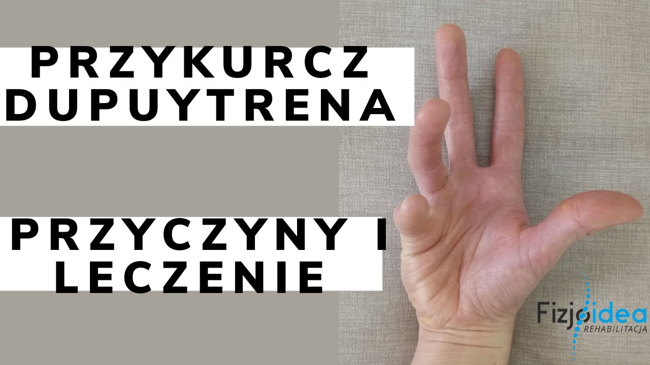 PRZYKURCZ DUPUYTRENA- PRZYCZYNY I LECZENIE [fizjoidea]