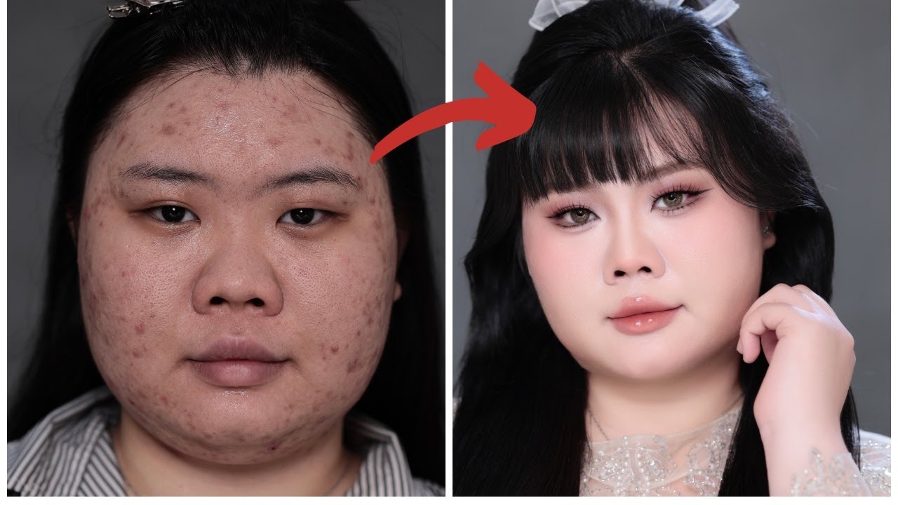 Hướng dẫn trang điểm c&ocirc; d&acirc;u khuyết điểm da mụn vi&ecirc;m / H&ugrave;ng Việt Makeup