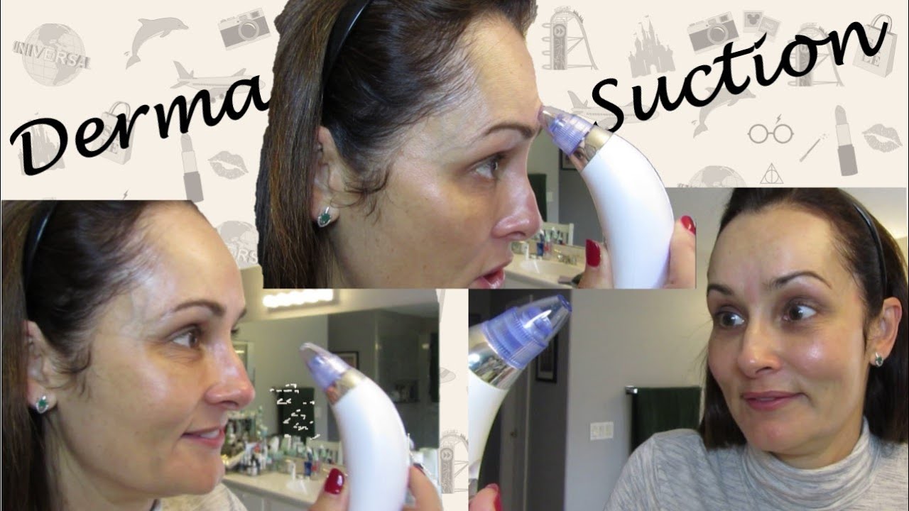 Derma Suction FUNCIONA?