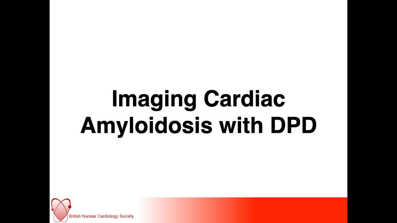 Cardiac Amyloidosis