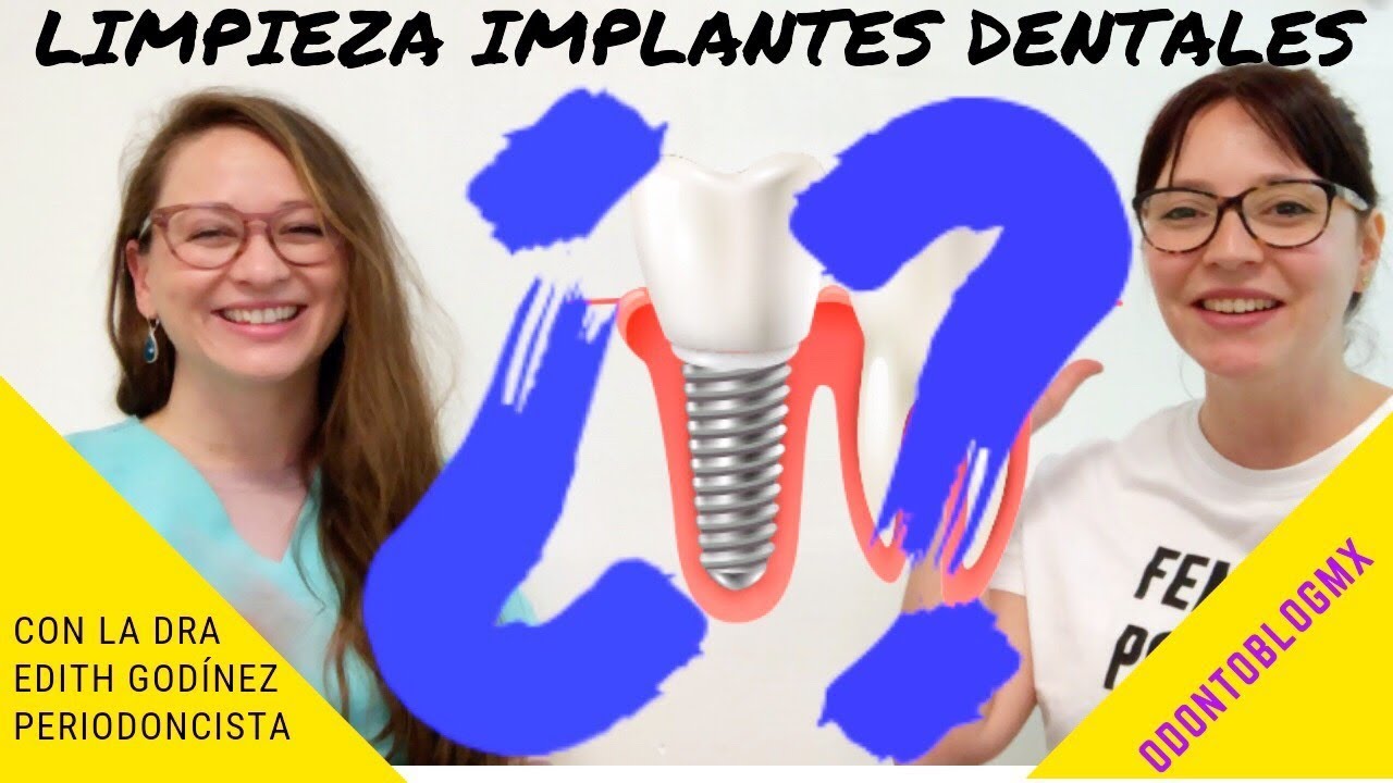 LIMPIEZA DE IMPLANTES DENTALES 🦷 con Dra Edith Godínez Padilla