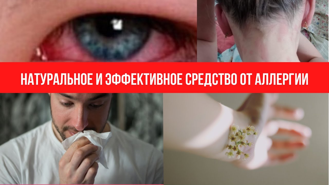 Натуральное и эффективное средство от аллергии