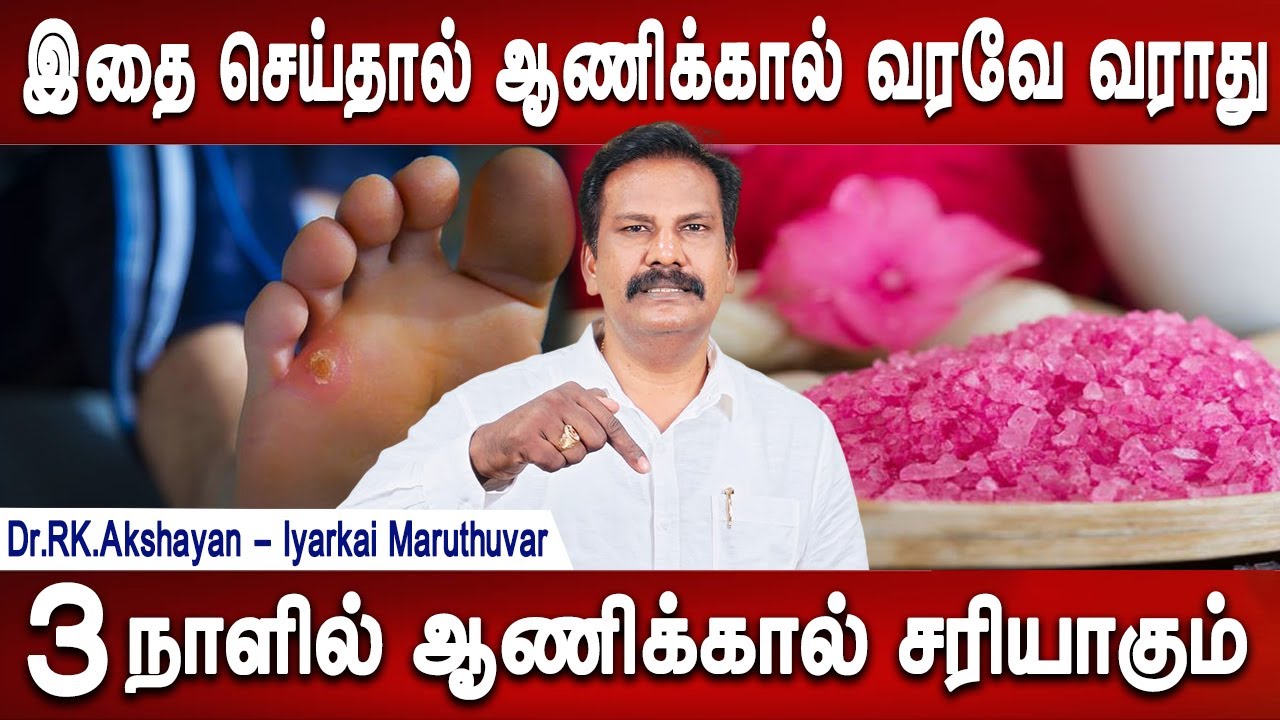 வெள்ள மஞ்சள் நம் உடம்பில் இருந்து வெளியாக வேண்டும் | foot corn remedy | Dr.Akshayan | mrladies