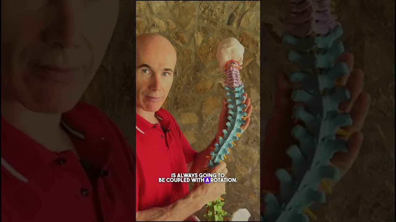 Реберный горб при сколиозе #scoliosisawareness
