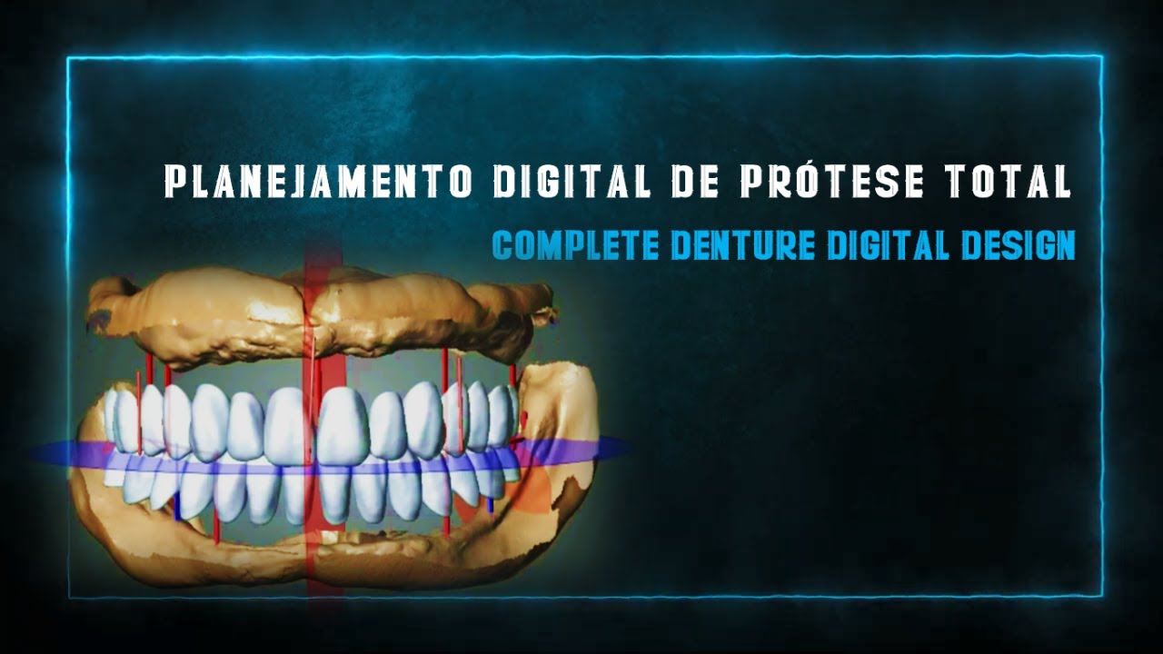 Planejamento Digital de Prótese Total (Complete Denture Digital Design)