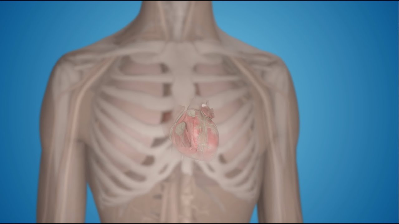 What Is a Pacemaker and How Does It Work?