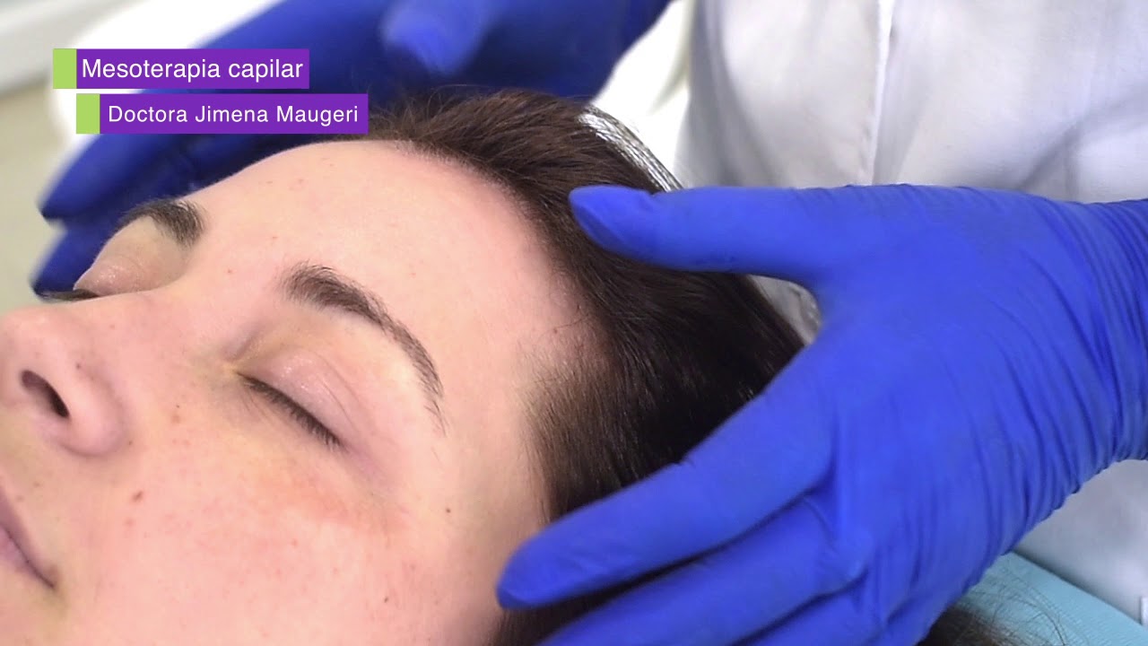 Previene la caída del cabello con la Mesoterapia capilar