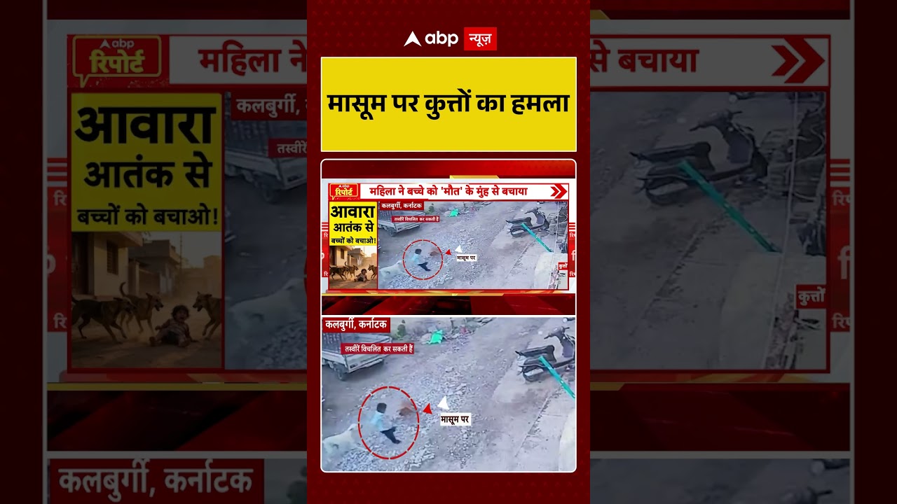 Viral News : मासूम पर कुत्तों का हमला | #ytshorts #dogbitecases #dogattack #viralvideo #viral