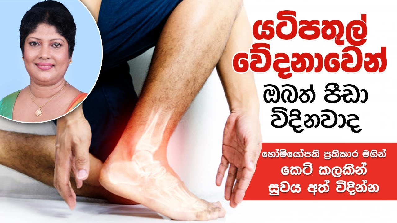 හෝමියෝපති ප්‍රතිකාර මගින් යටිපතුල් වේදනාව සදහටම නැති කරගන්න.