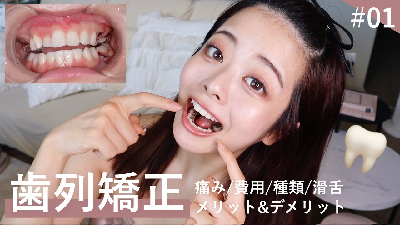 【歯列矯正】死ぬほど痛いけど、マジで始めて良かった…！費用やリアルな痛み、メリットデメリットなどお話します。