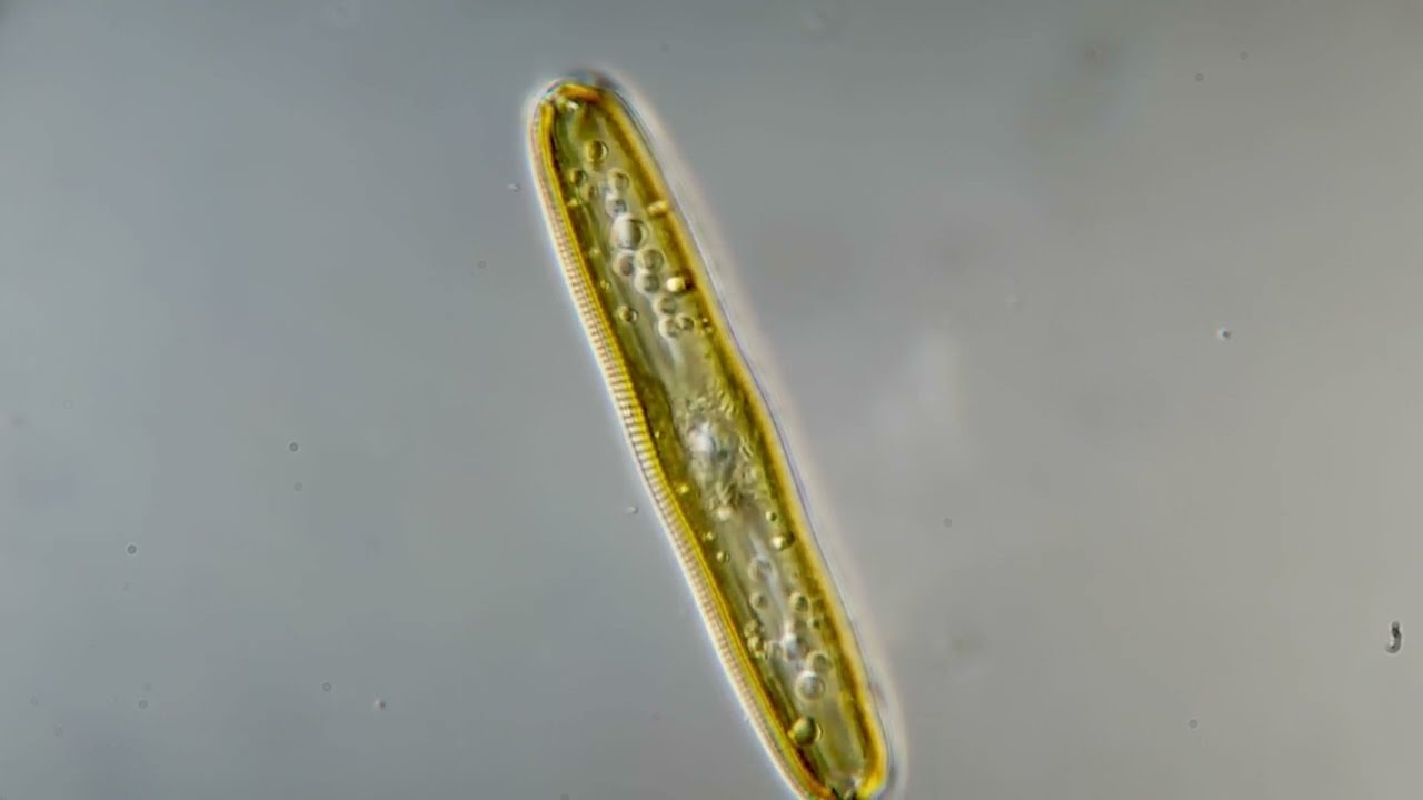 Diatom 4K DIC
