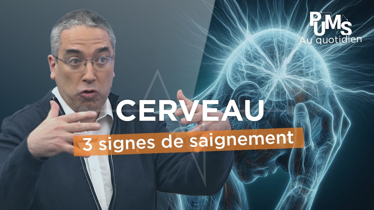 Hématome, ANÉVRISME, MICRO-SAIGNEMENT... Notre neurologue donne les clés pour savoir et AGIR VITE