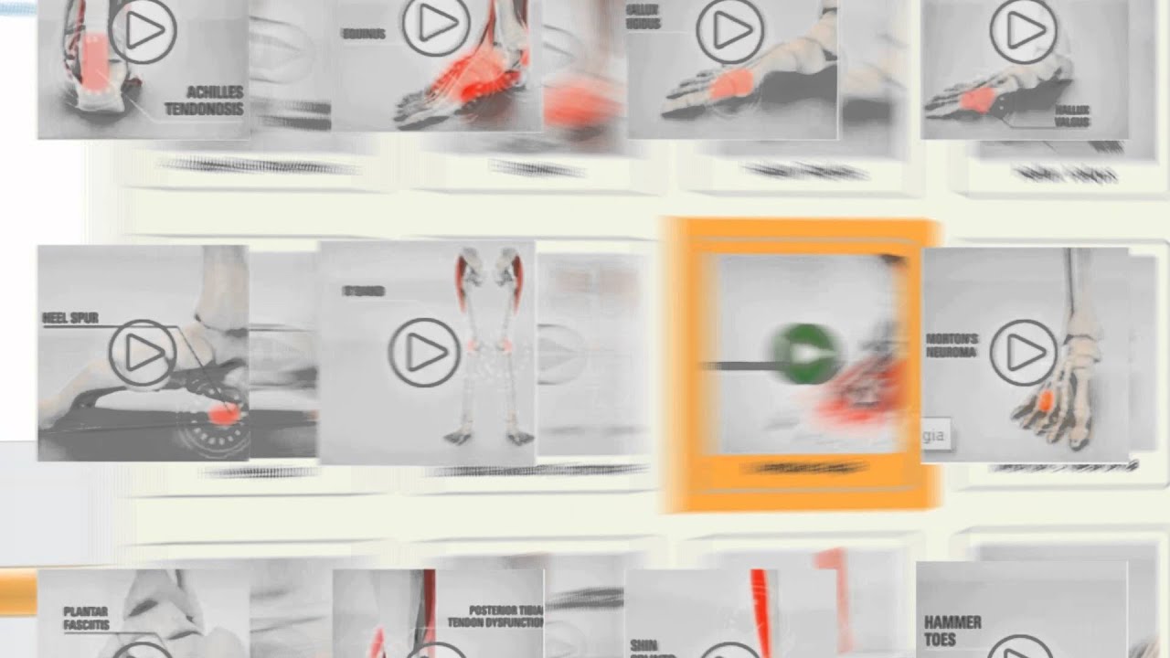 The Orthotic Group's State-Of-The-Art GaitScan System