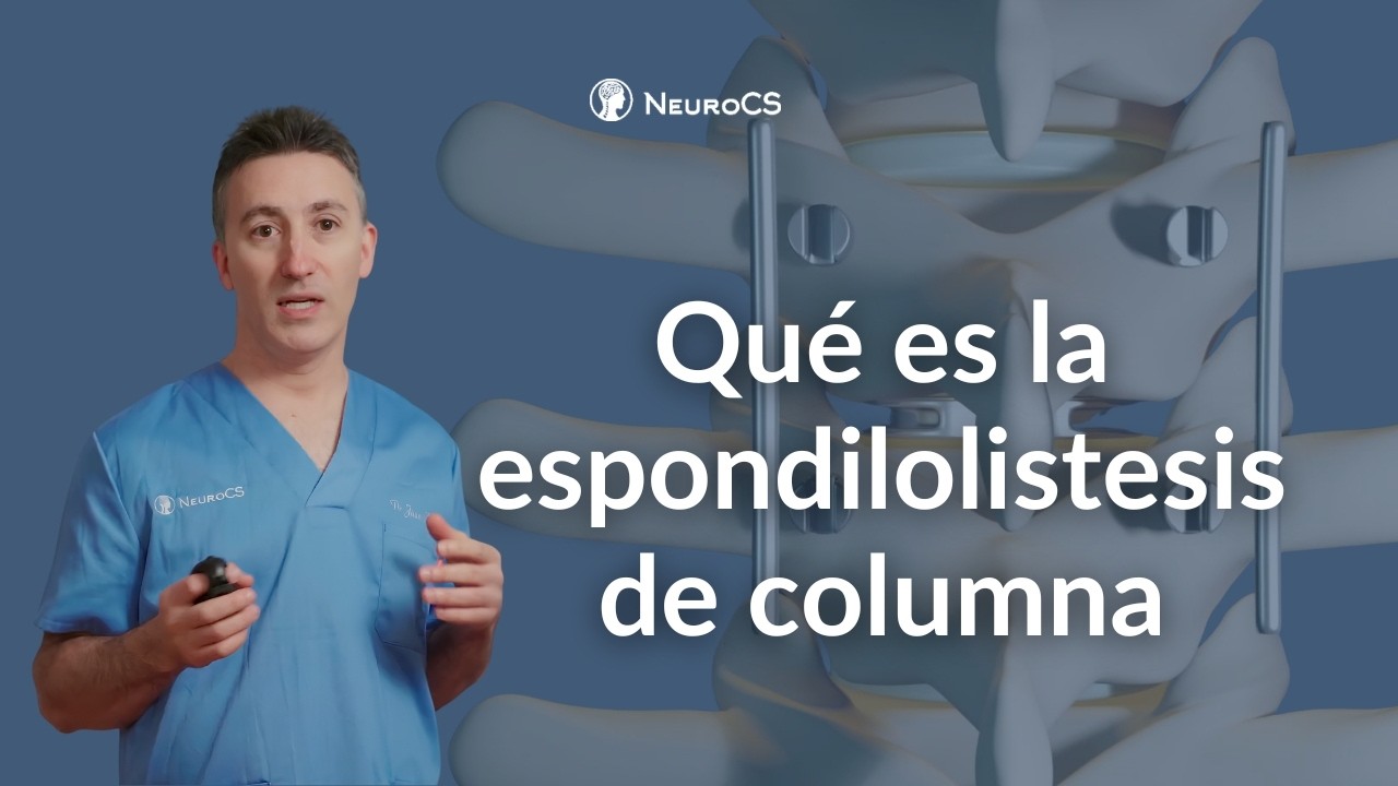Espondilolistesis de columna: qu&eacute; es, s&iacute;ntomas, causas y tratamiento en Espa&ntilde;a