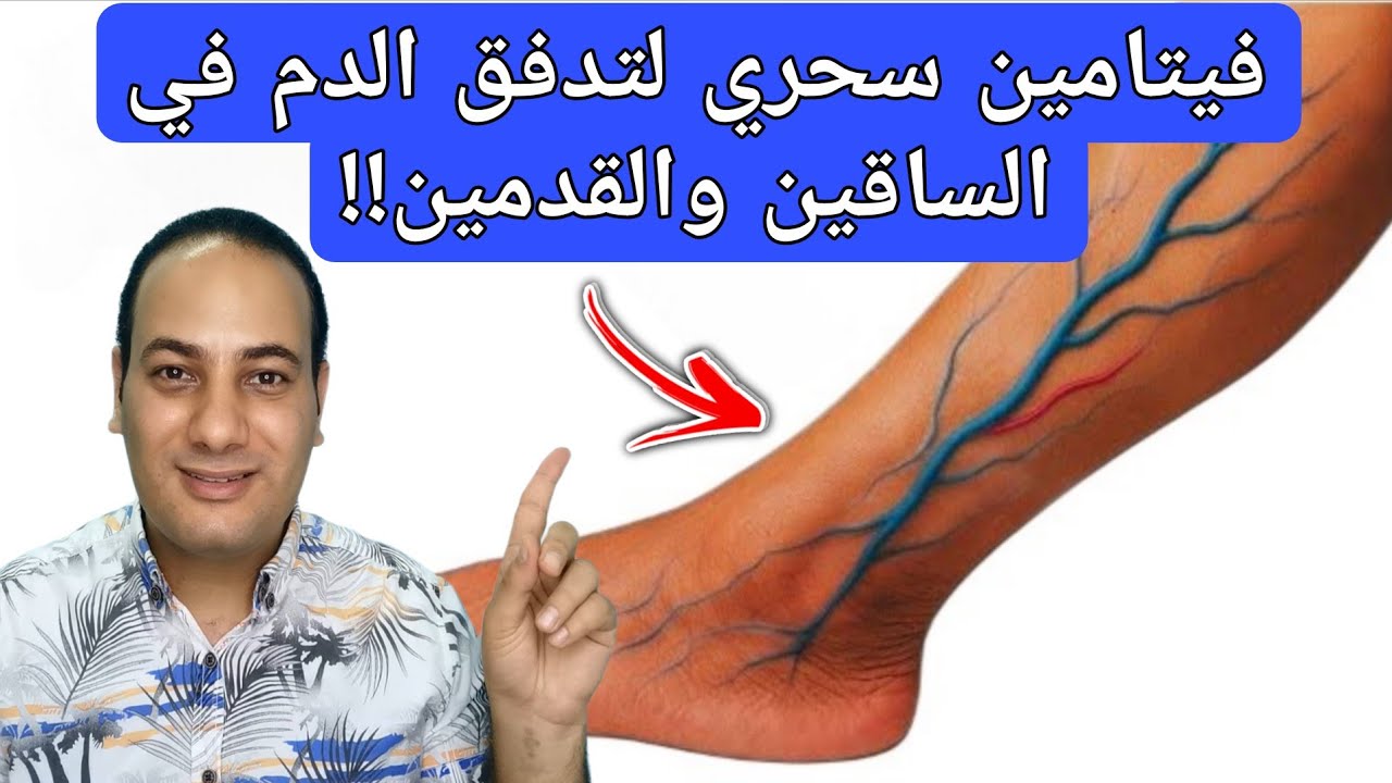 فيتامين سحري لتدفق الدم في الساقين والقدمين/أفضل طعام ينهي برودة الأطراف/وداعا تنميل وحرقان الأطراف!