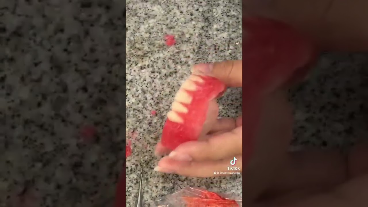 Como &eacute; feito uma pr&oacute;tese total! Odontologia