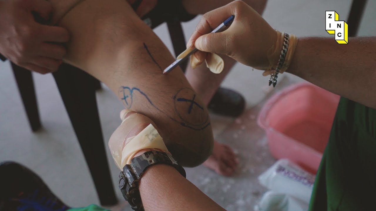 This amazing Filipino man builds prosthetic legs for fellow amputees