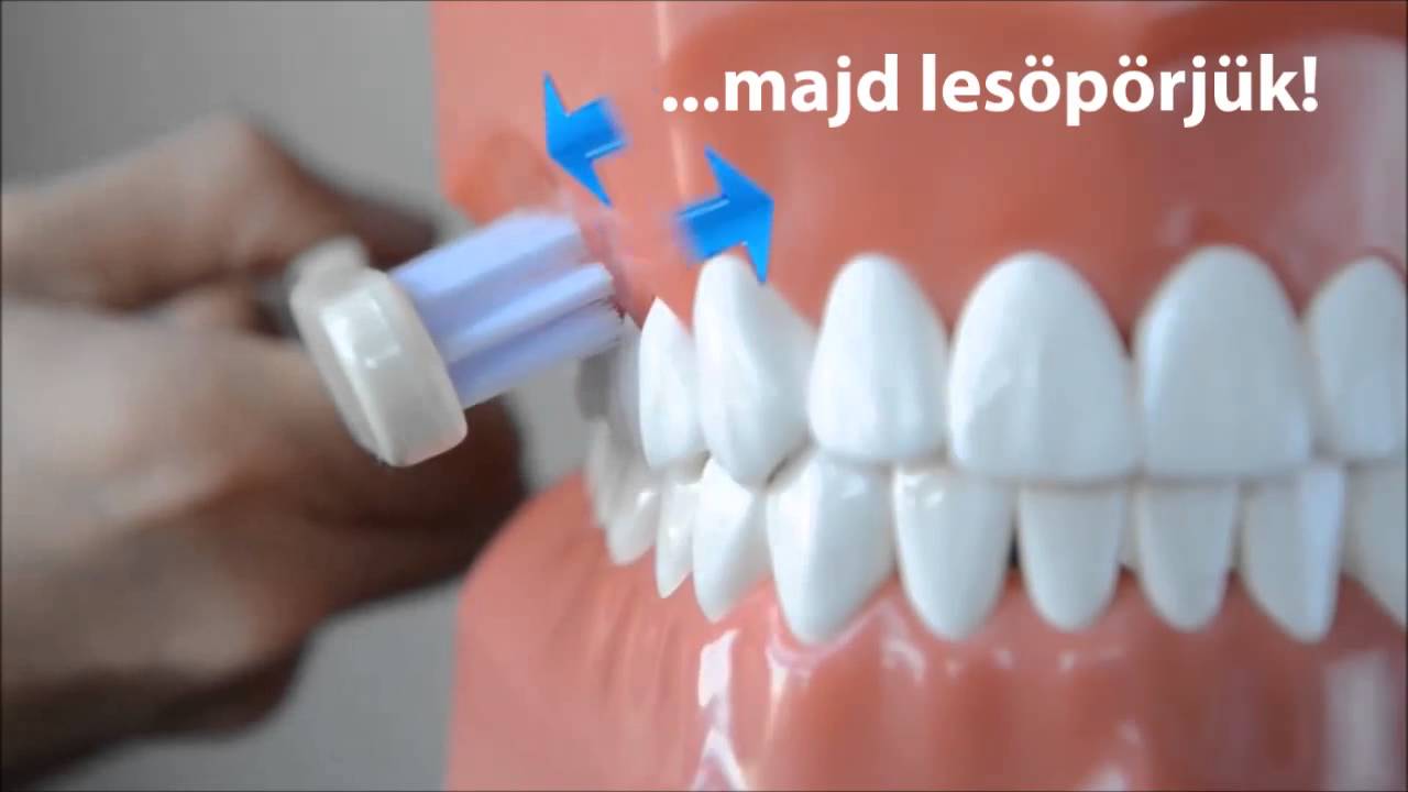Smile Designers - Helyes fogmosási technikák