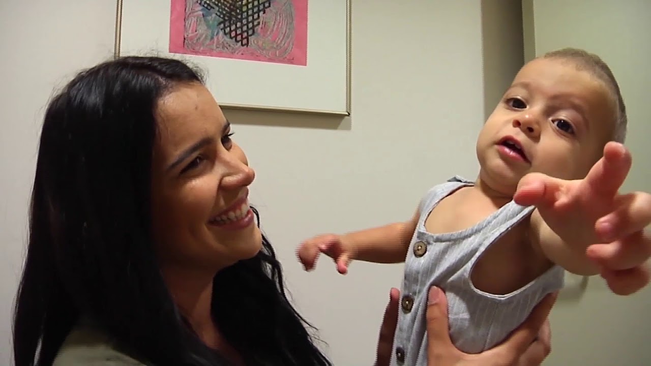 9 month old with craniosynostosis