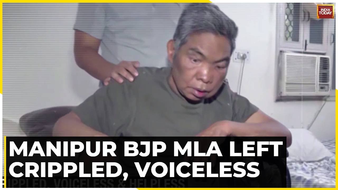 Manipur News: BJP MLA Vungzagin Valte, Who Was Attacked Earlier, Now Confined To Bed