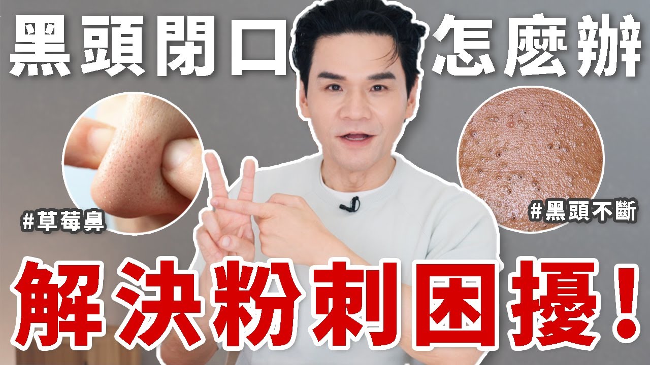 👃#粉刺 真的能清乾淨嗎？怎麽正確保養避免 #黑頭 #閉口？一次終結你的所有粉刺問題！✨