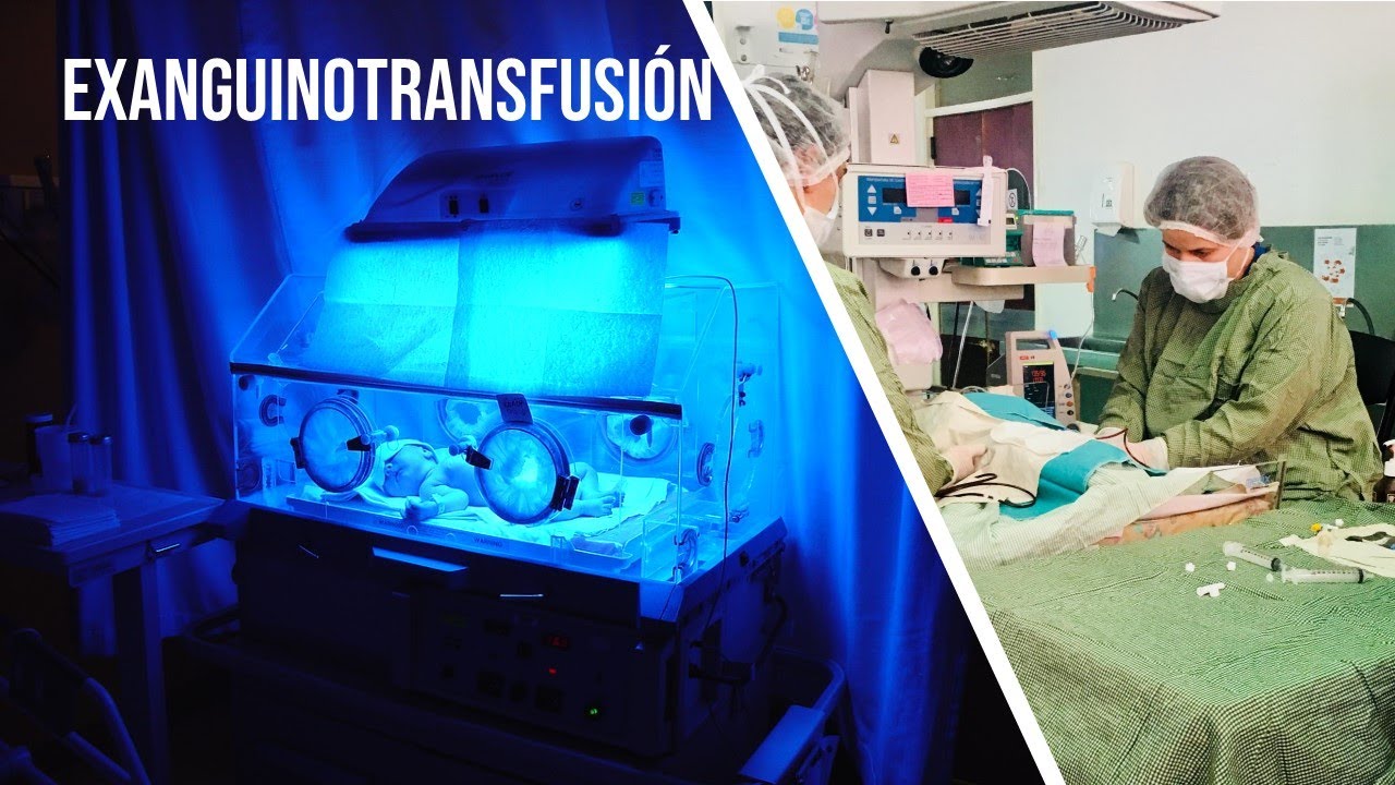 Exanguinotranfusion