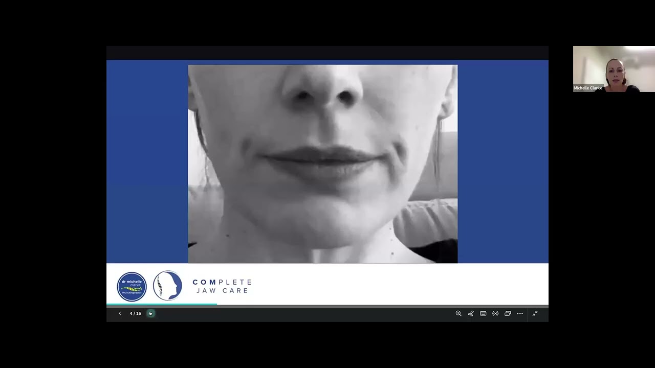 TMJ Treatment: How Chiropractors Fix Jaw Pain and Alignment