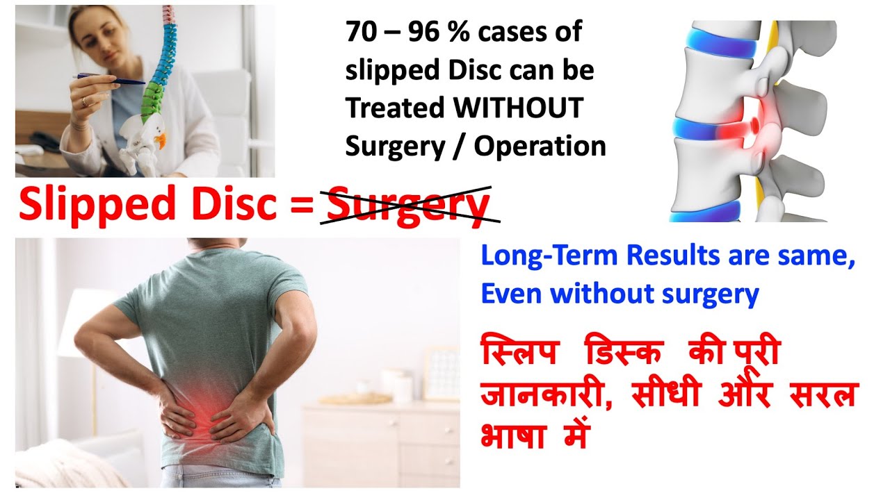 Slip Disc/Scatica क्या है? 70–96% without surgery ठीक हो सकती है, पूरी जानकारी, सीधी और सरल भाषा में