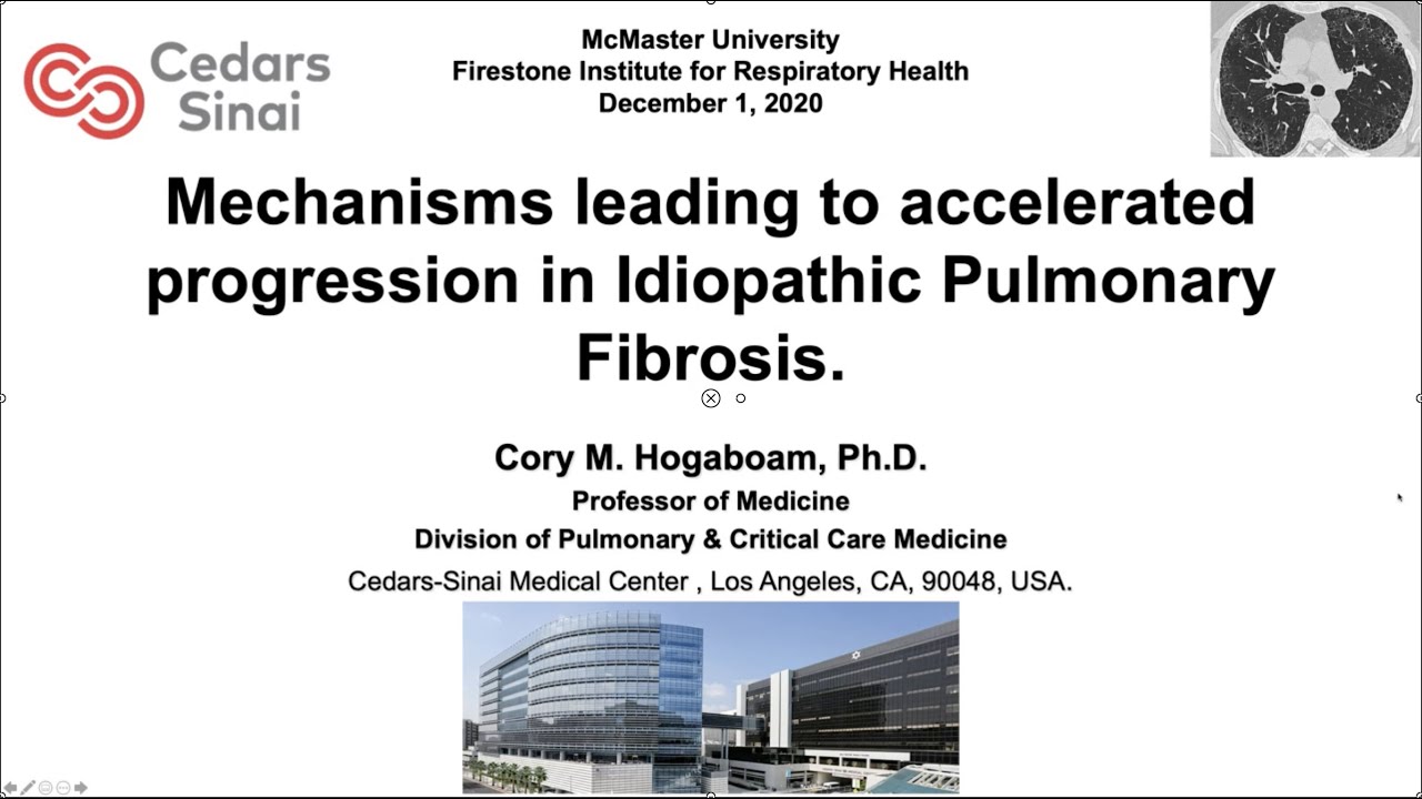Mechanisms Leading to Accelerated Progression in Idiopathic Pulmonary Fibrosis: Dr. Cory Hogaboam