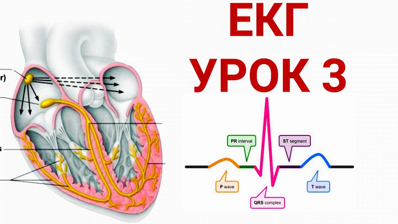 Основи аналізу ЕКГ. Урок 3