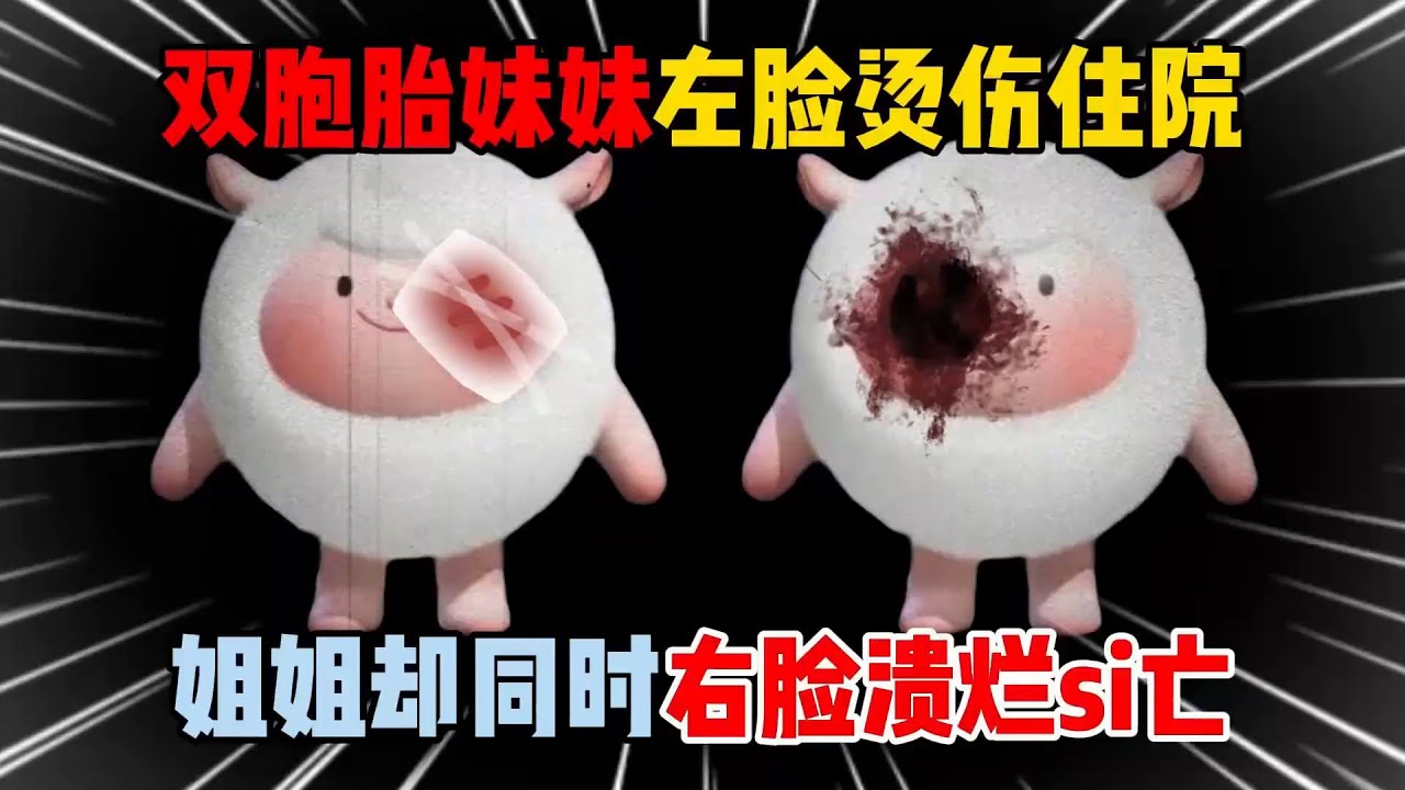 蛋仔派对：双胞胎妹妹左脸烫伤住院，姐姐却同时右脸溃烂si亡！【蛋仔二师兄】