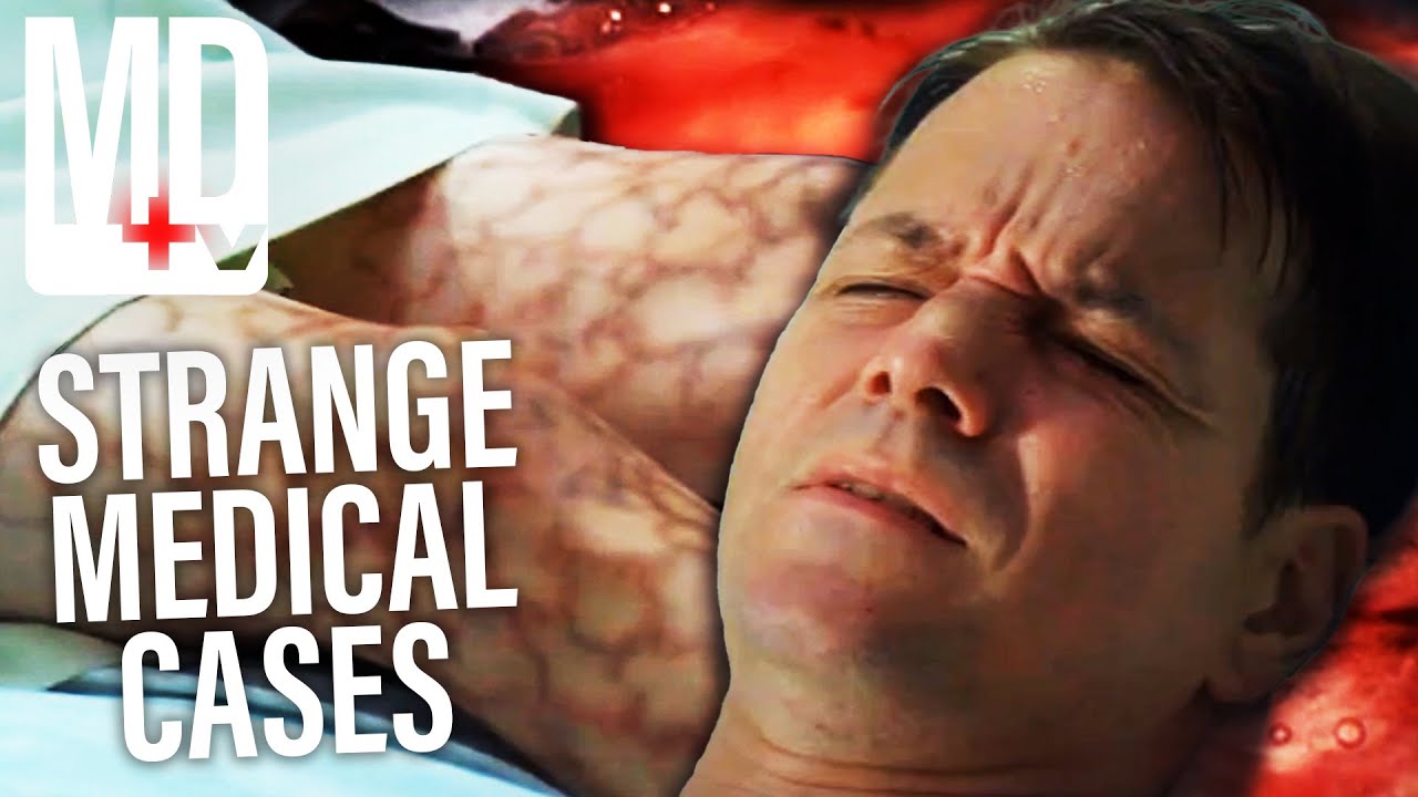 House Diagnosing Rare Diseases For 40 Minutes | House M.D | MD TV