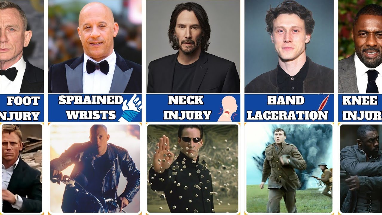 Hollywood Actors Who Got Injured While Filming 😱 | Behind the Scenes Accidents