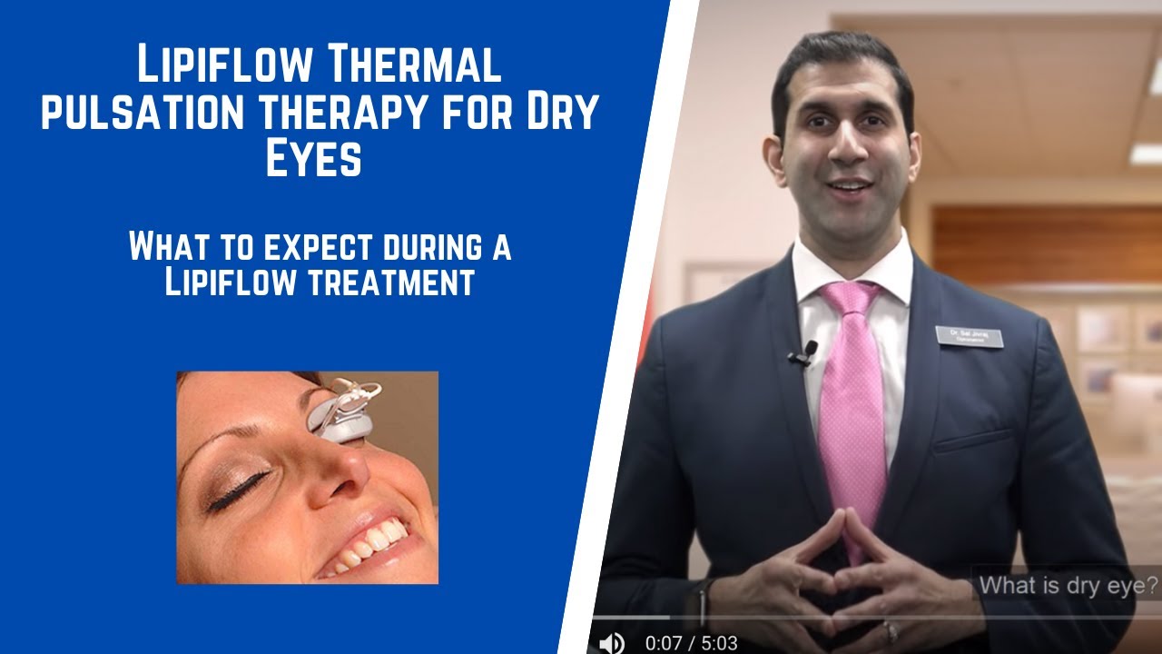 Lipiflow Thermal pulsation therapy for Dry Eyes