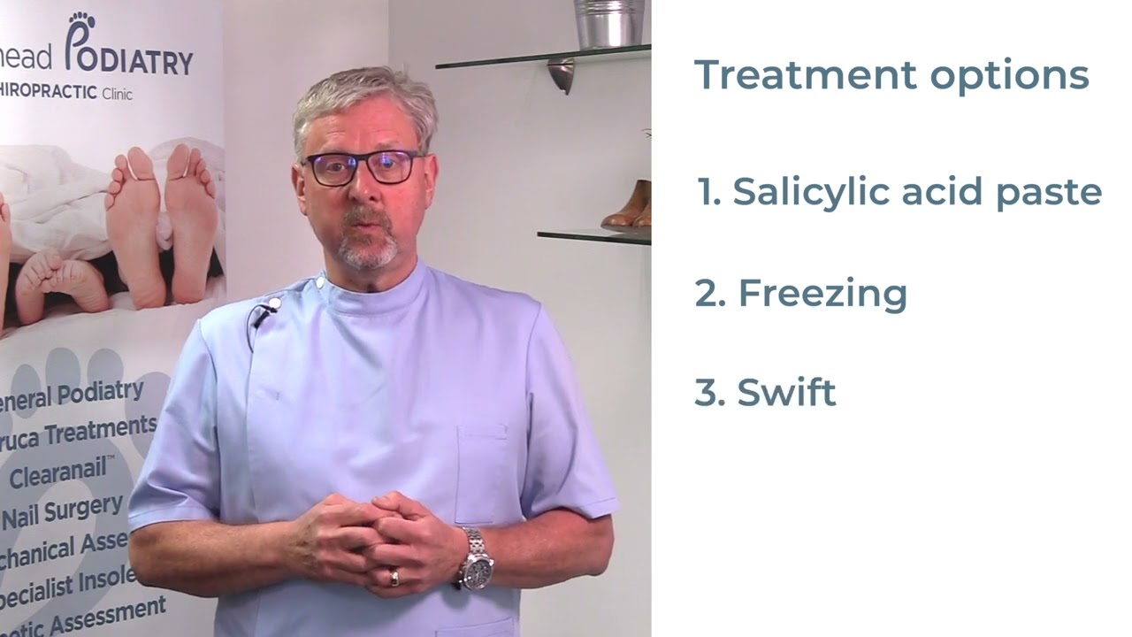 What are your treatment options for verrucas