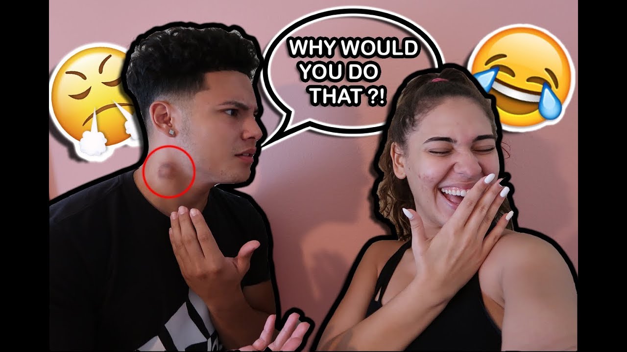I GAVE HIM A HICKEY WHILE SLEEPING TO SEE HOW HE WOULD REACT !