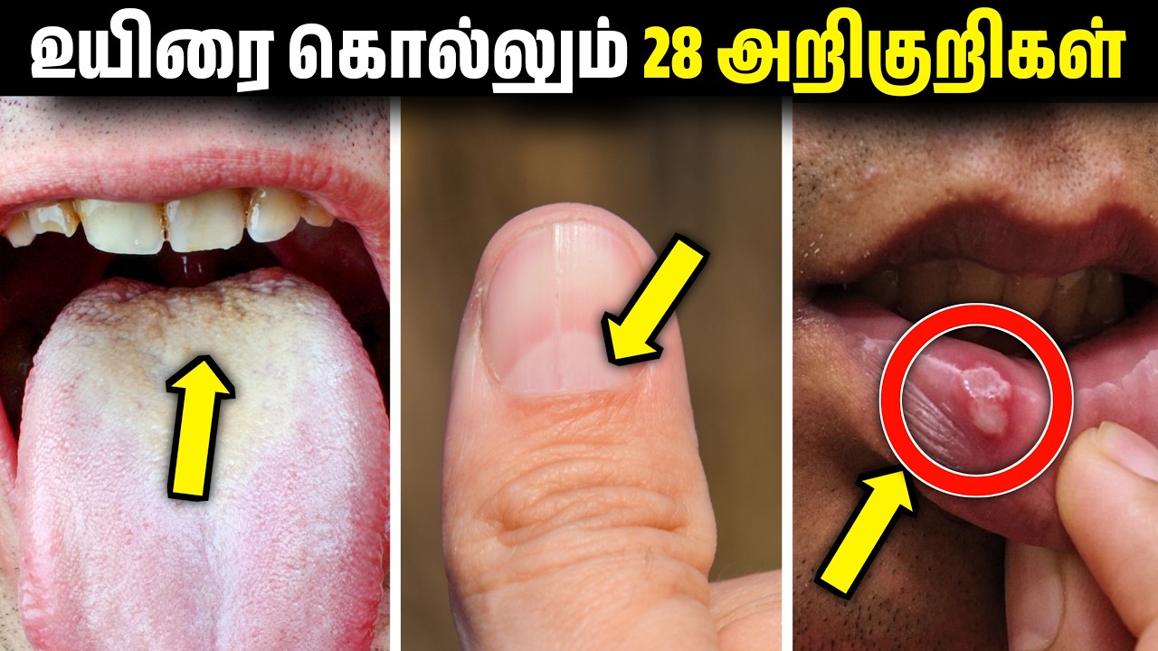 28 Dangerous Signs ⚠️| உடனே இதையெல்லாம் Check பண்ணி பாருங்க | Vitamin Deficiency Symptoms