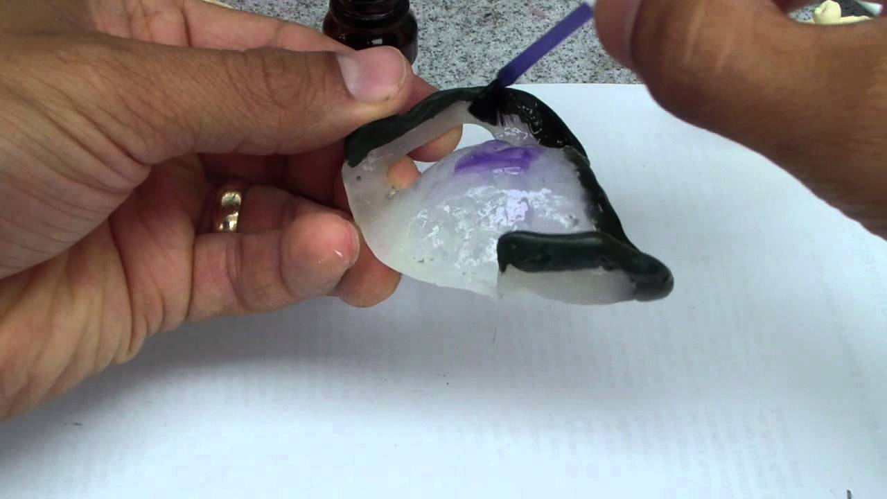 Immediate Denture Sectional Impression Technique